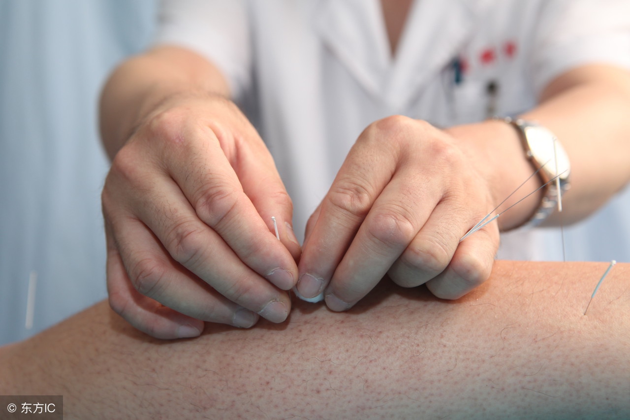 学习针灸用什么练习,学习针灸要学多长时间可以学会