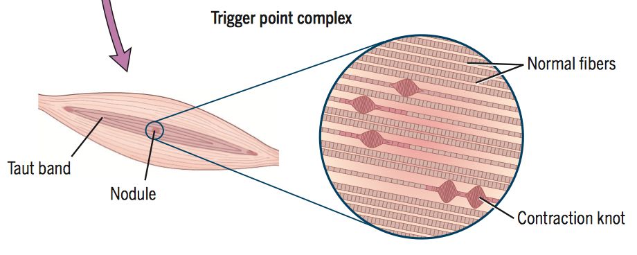 足跟痛中医按哪里一招教你解决,足跟痛一招教你解决视频