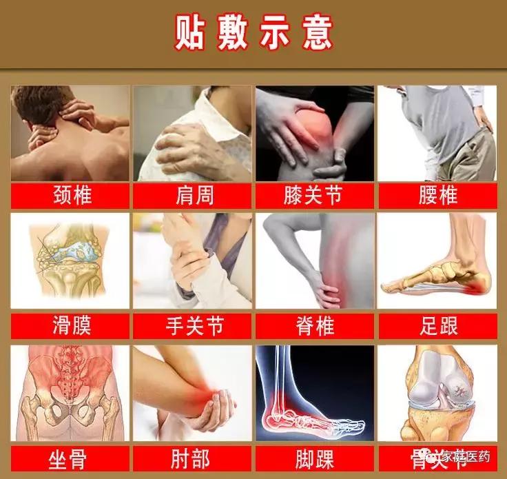 关节损伤贴什么膏药,胸锁关节损伤贴什么膏药