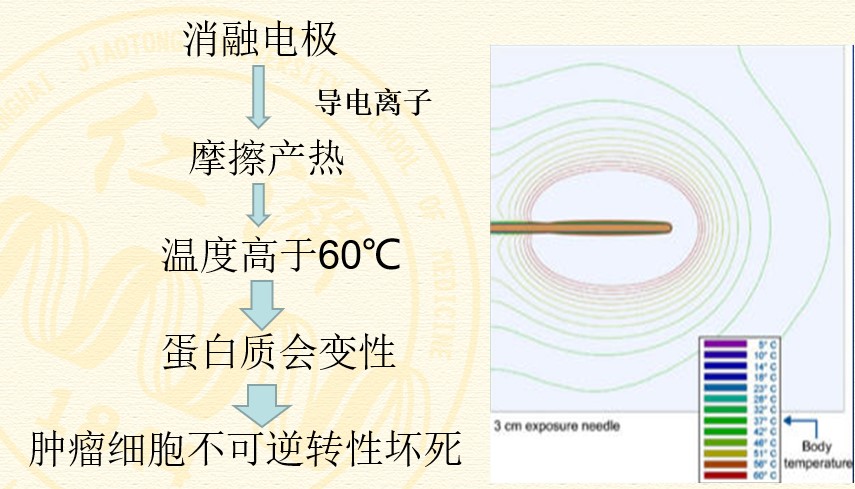 射频消融治疗肿瘤效果怎样,肝脏射频消融对肾脏有损伤吗