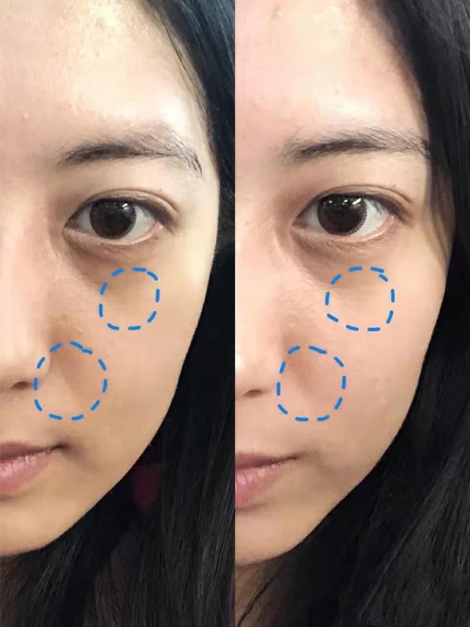 皮肤不清洁的后果视频,皮肤不清洁的危害