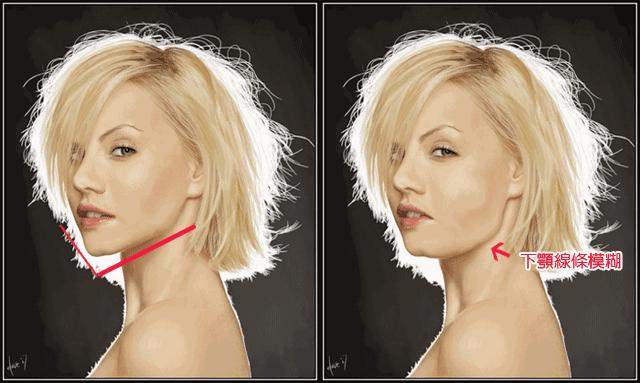 张宗学博士线雕案例分析,张宗学线雕案例