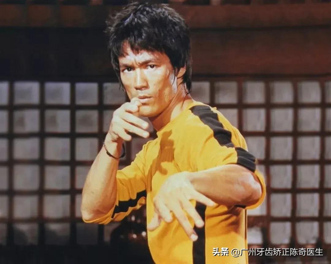 戴牙套会有下颌线,戴牙套的时候人会变丑吗