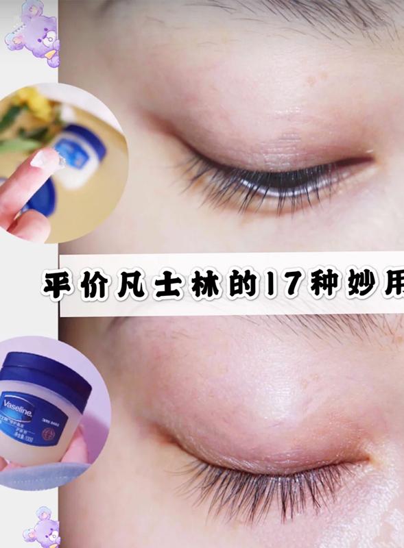 邓紫棋小红瓶,邓紫棋的金鱼嘴视频