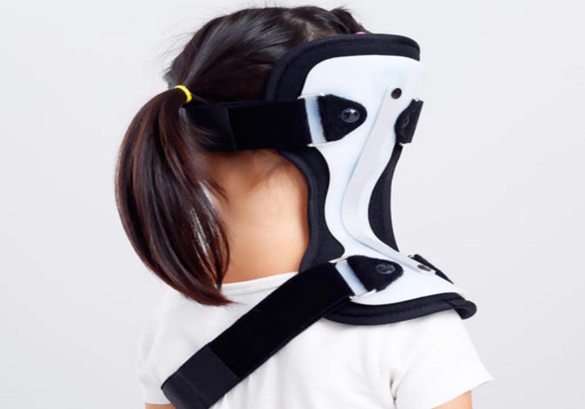 宝宝脖子轻微歪能治好么,宝宝脖子歪了是什么原因