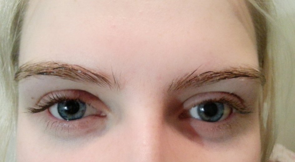 眼干涩疲劳用什么眼药水,眼疲劳干涩用什么滴眼液