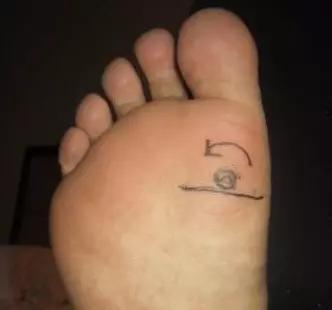 一病一绝招,治疗一病一穴奇效法