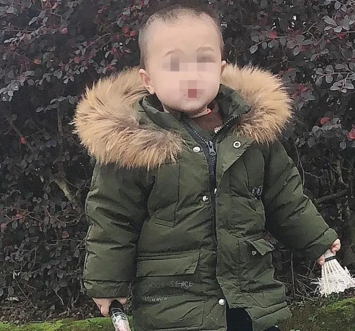 七个月的宝宝大面积烫伤警察帮助,小孩被火锅烫伤后怎么处理