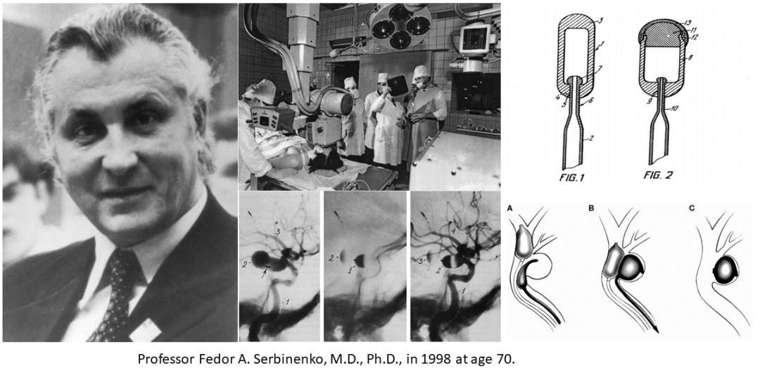 颅内动脉瘤血管栓塞治疗术后护理,颅内动脉瘤手术后血管渗血
