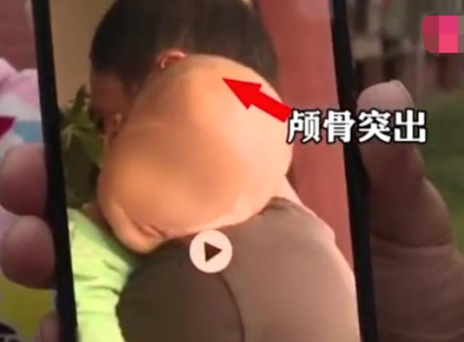 湖南郴州大头娃娃事件影响,郴州大头娃娃最近发生的事