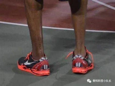 崴脚超过24小时是热敷还是冷敷,崴脚超过48小时是热敷还是冷敷