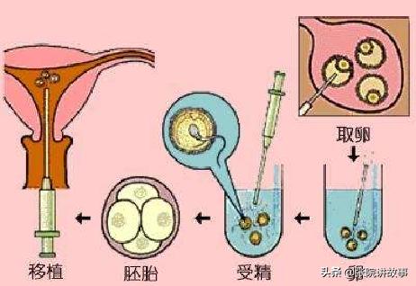 「张院讲故事」男性先天性输精管缺失，还能生个自己的宝宝吗？