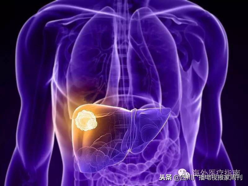 脂溢性脱发的福音,华西治疗脂溢性脱发价格