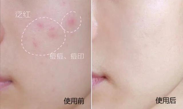 澳洲chantelle羊胎素面霜 (正品澳洲aus life绵羊油奶冻面霜)