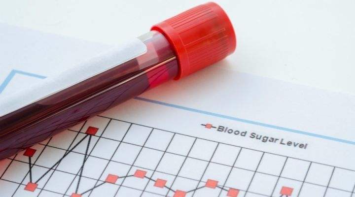 卵巢多囊综合征症状,多囊卵巢综合征有什么症状啊