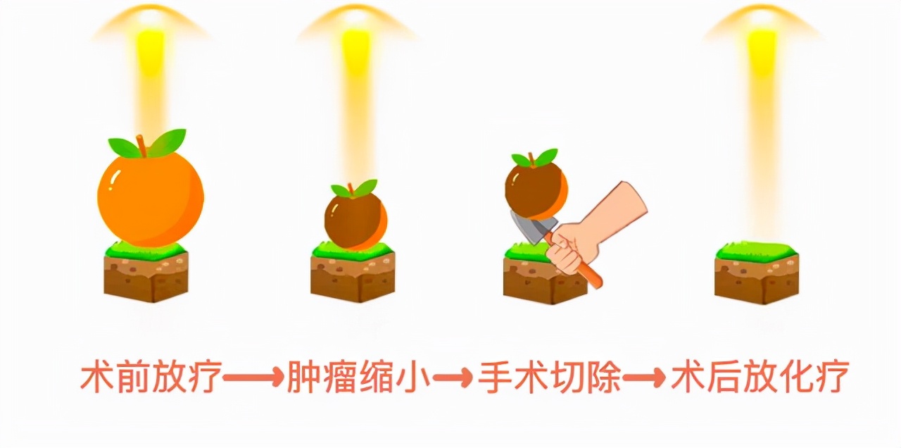 晚期肠癌防止扩散吃什么药好呢,早期的肠癌患者能治好吗