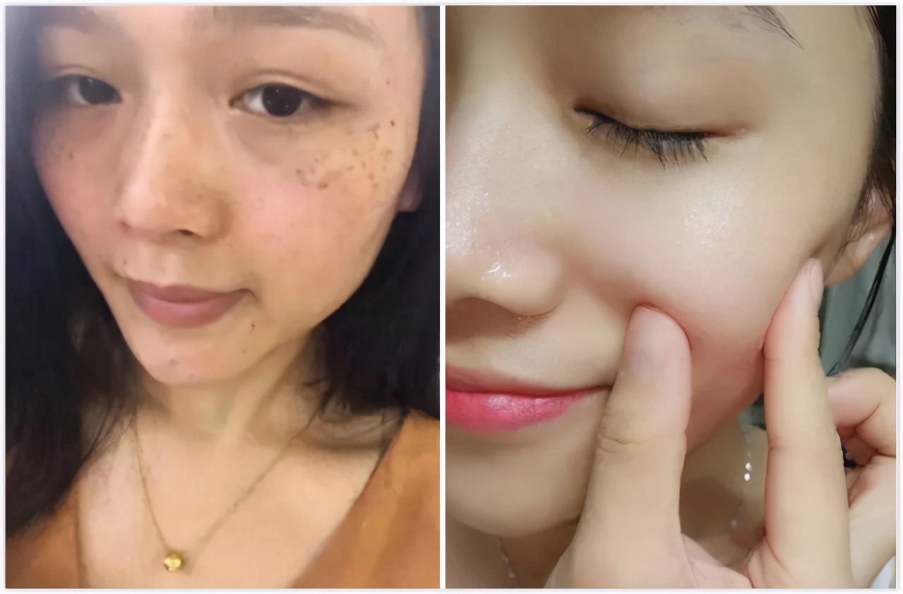 润泉贝儿祛斑产品怎么样,润泉贝儿美白祛斑套