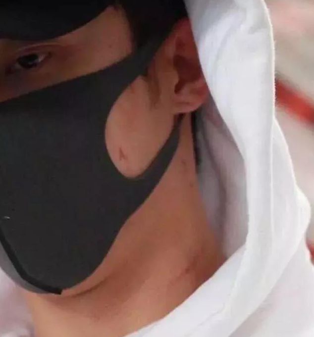 被绿又被打?还为爱自杀?至于吗