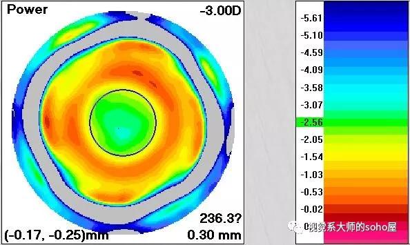 硬性隐形眼镜更适合超高度近视,高度近视最适合的透明隐形眼镜
