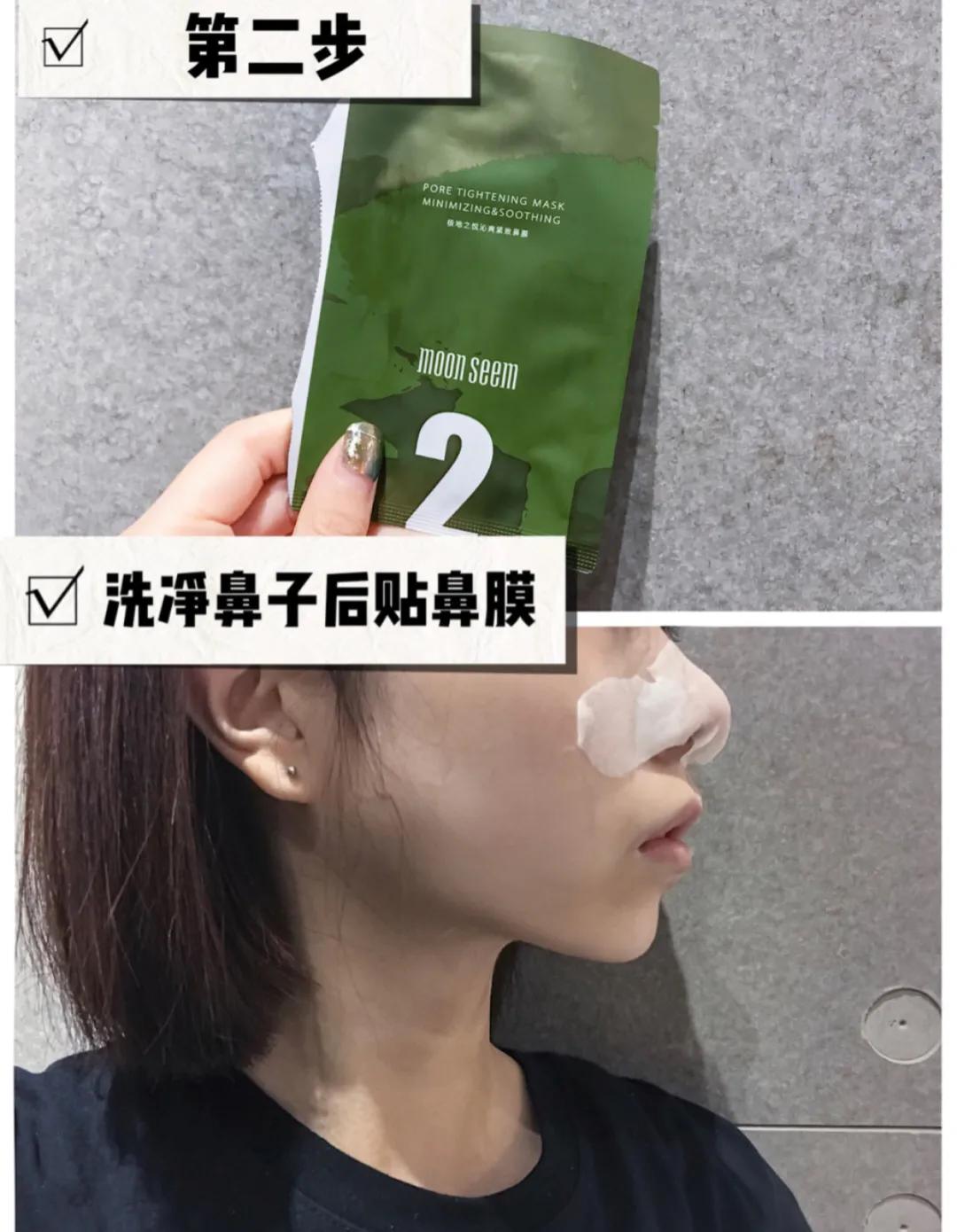 亲测真正有效去黑头粉刺产品,黑头连根拔起还会再长吗