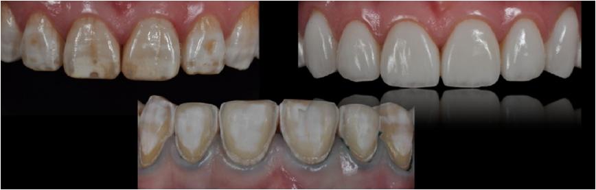 口腔科诊疗指南及技术操作常规,口腔科疾病的最新诊疗护理措施