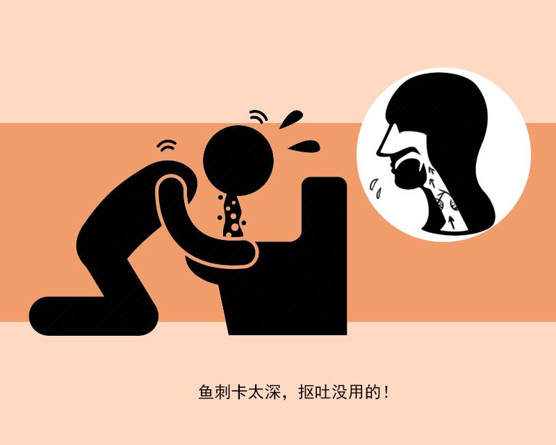 鱼刺卡喉吞饭怎么处理,鱼刺卡喉后喝醋吞饭团