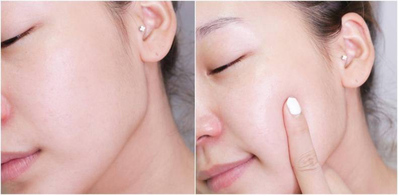 皮肤暗沉迅速拯救,暗沉皮肤怎样改善肤质