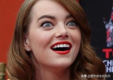 想要摆脱法令纹方法,告别法令纹最好的方法