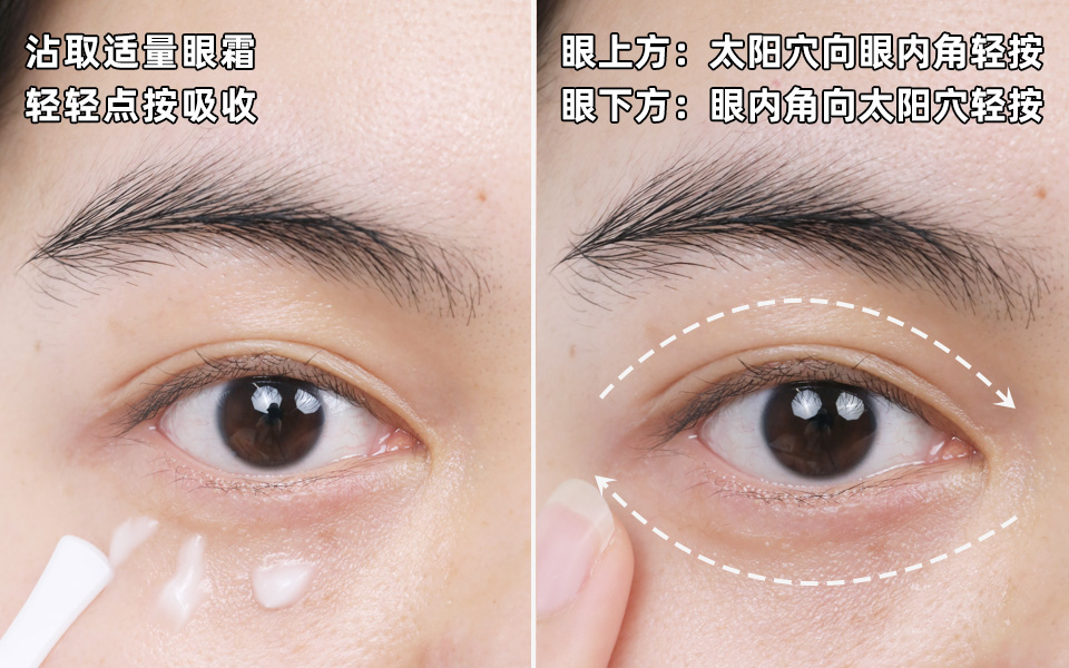 一用眼霜眼袋就严重,第一次用眼霜居然长了脂肪粒