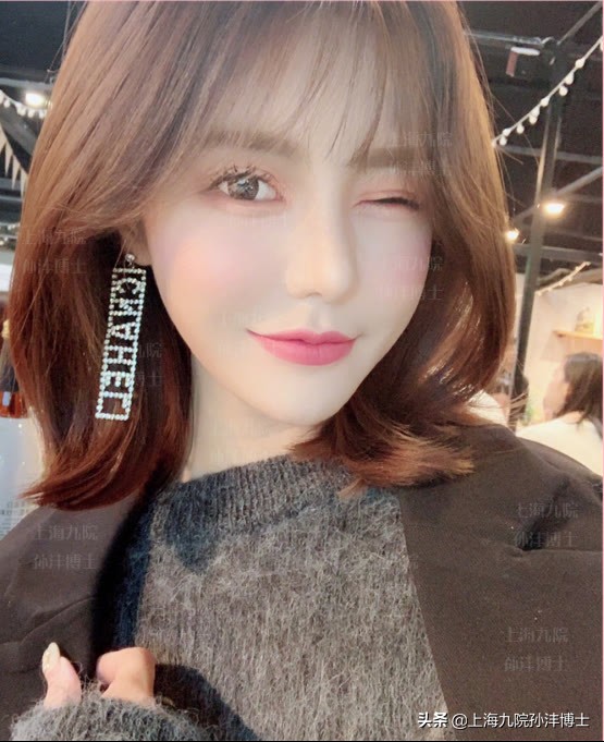 刚做完双眼皮闭眼总翻白眼正常吗,割了双眼皮为啥眼睛老流泪