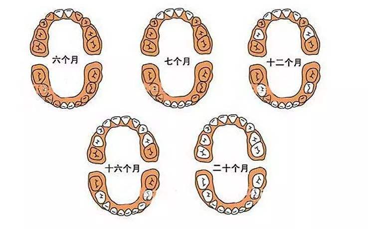 儿童乳牙更换年龄和顺序,宝宝乳牙萌出顺序