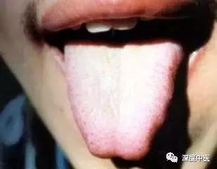 湿热体质的症状和调养,湿热体质的症状及调节