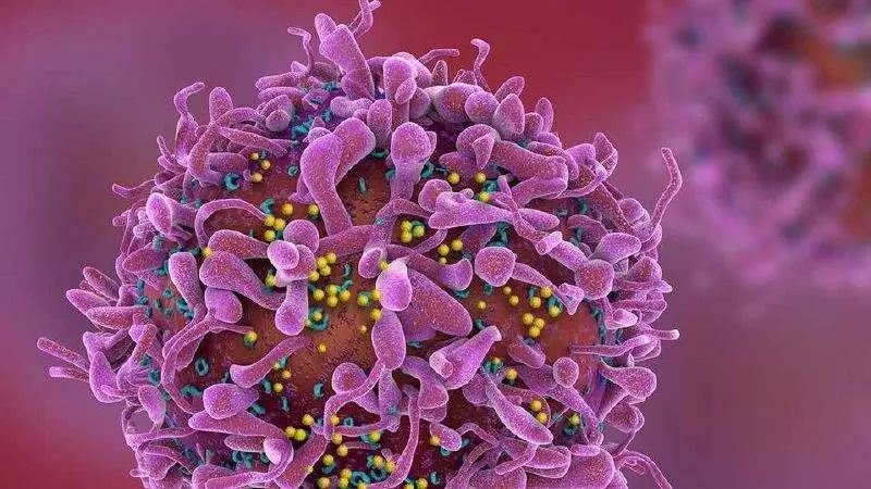 女性同时感染淋病与艾滋病,衣原体感染和艾滋病有关吗