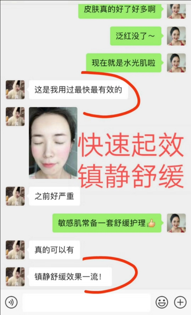 快速缓解痘痘泛红的办法,怎么祛除红血丝敏感痘痘
