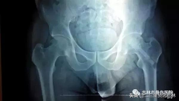 从医30余年，他治疗数以万计骨伤骨病患者