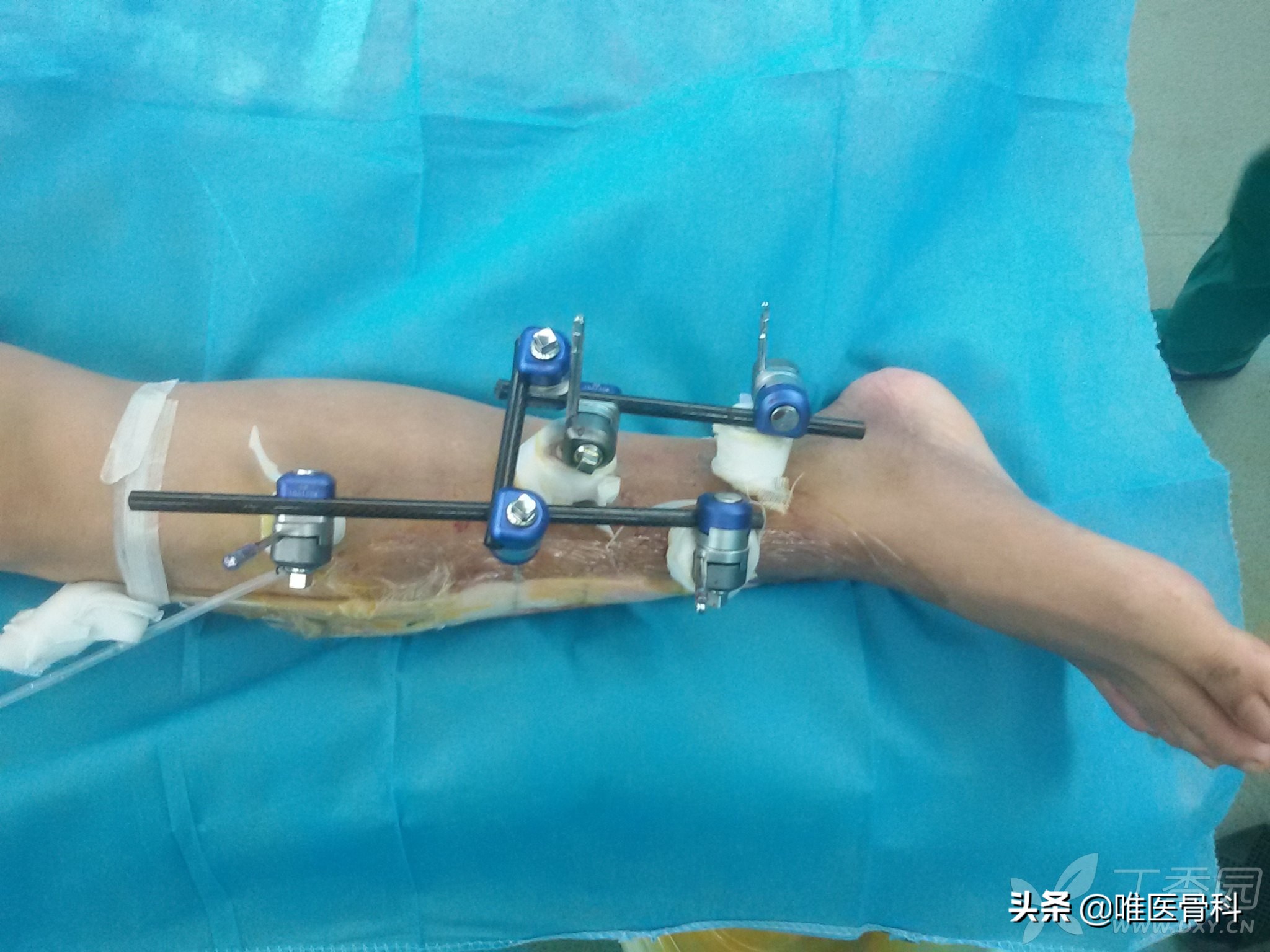 一文读懂注意力机制,一文读懂这些事儿