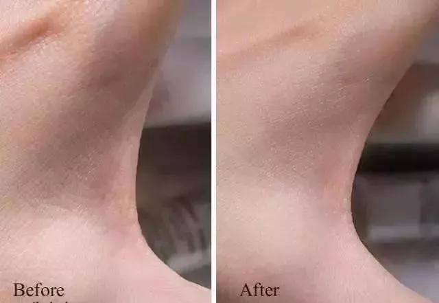 祛除角质细纹的护手霜,干裂护手霜秋冬季