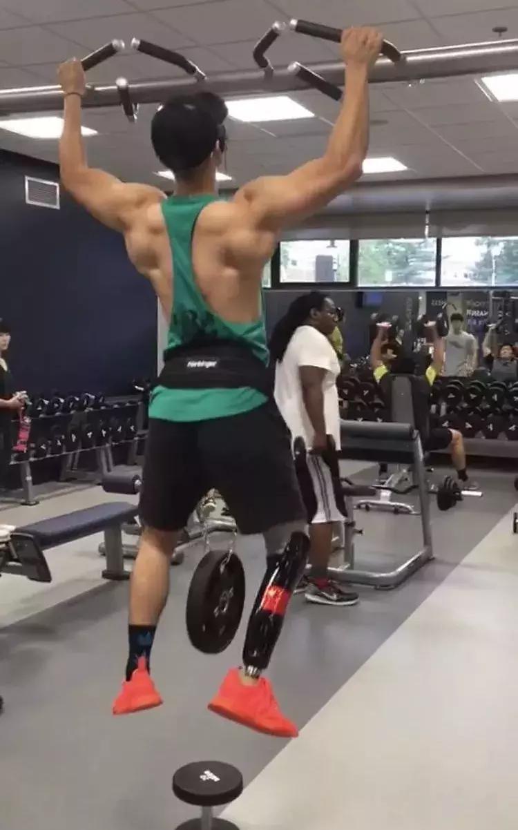 中国留学生被截肢,励志留学生