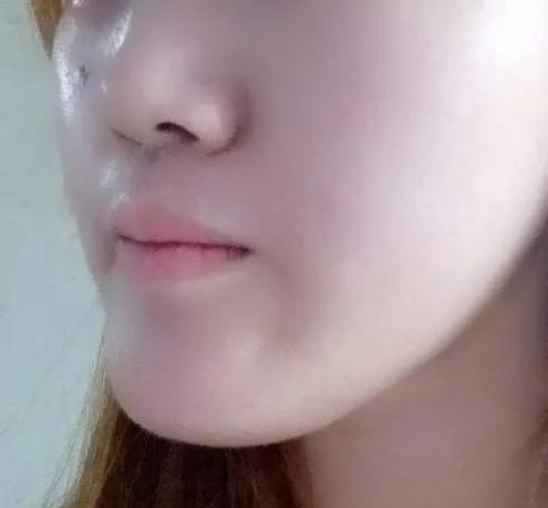 几种形状下巴,下巴四种类型