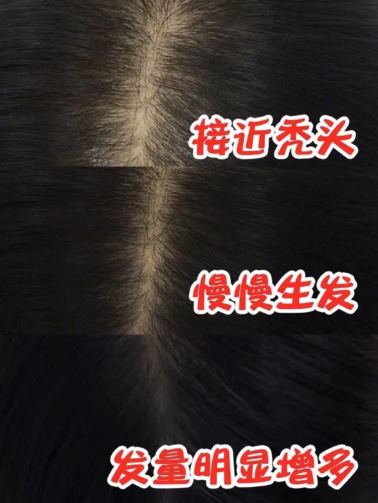 代替海飞丝洗发水,海飞丝洗发水和潘婷洗发水哪种好