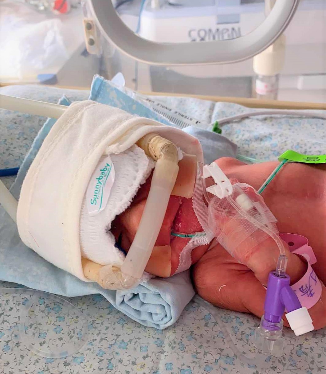 中国首例经导管主动脉瓣置换术,微创瓣膜置换手术预期效果