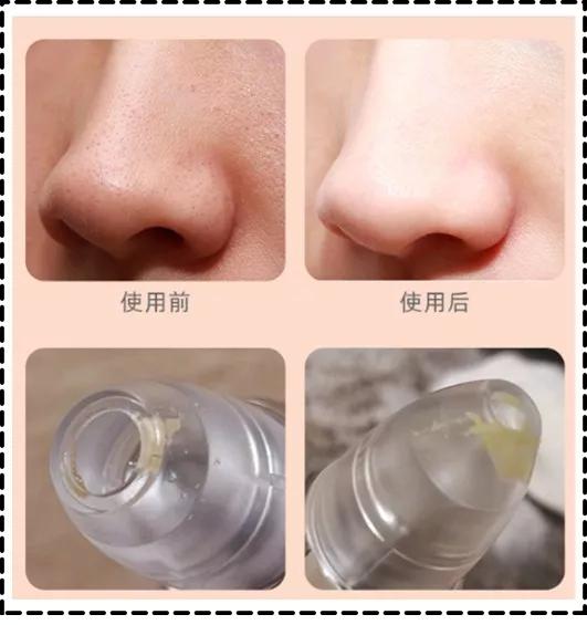 十大美容单品排行榜,这几年流行的养生美容爆品