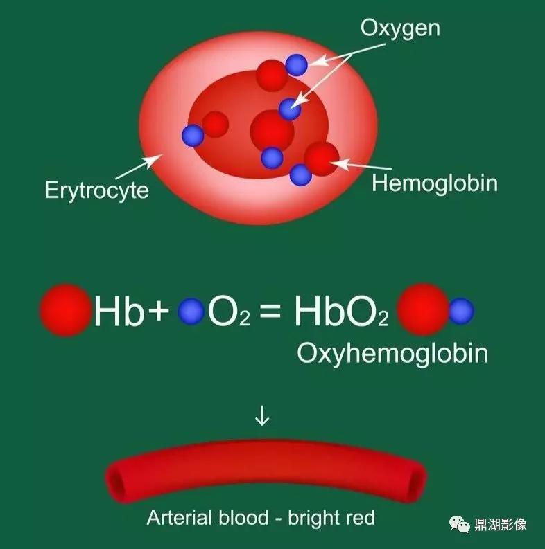 不简单|脑出血超详细学习笔记