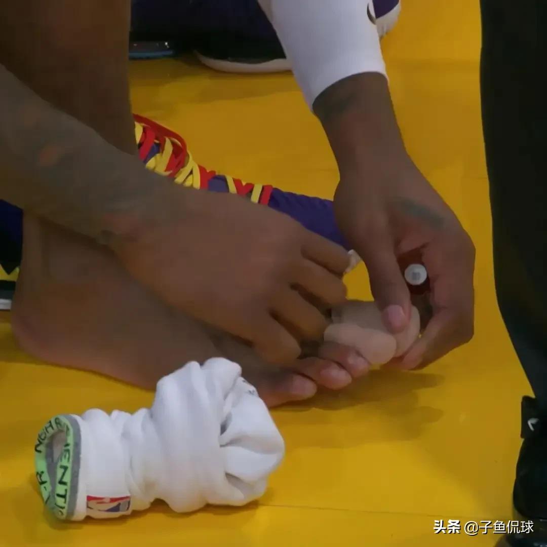 “庄神”的愚人节主场首秀，被一个脚趾甲盖搞砸了。