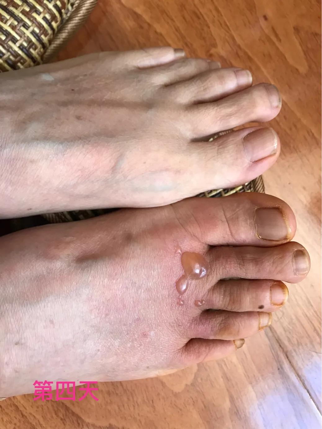 自己用中药熬的面膜靠谱吗,自己用中药做的面膜好吗