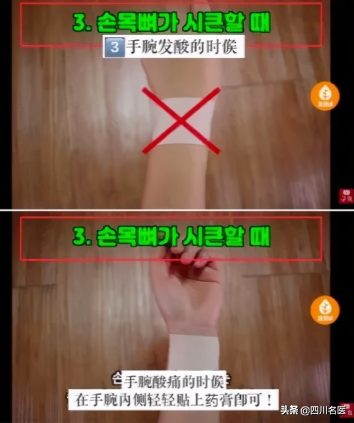 哪儿疼贴哪儿,膏药是不是哪儿疼贴哪儿