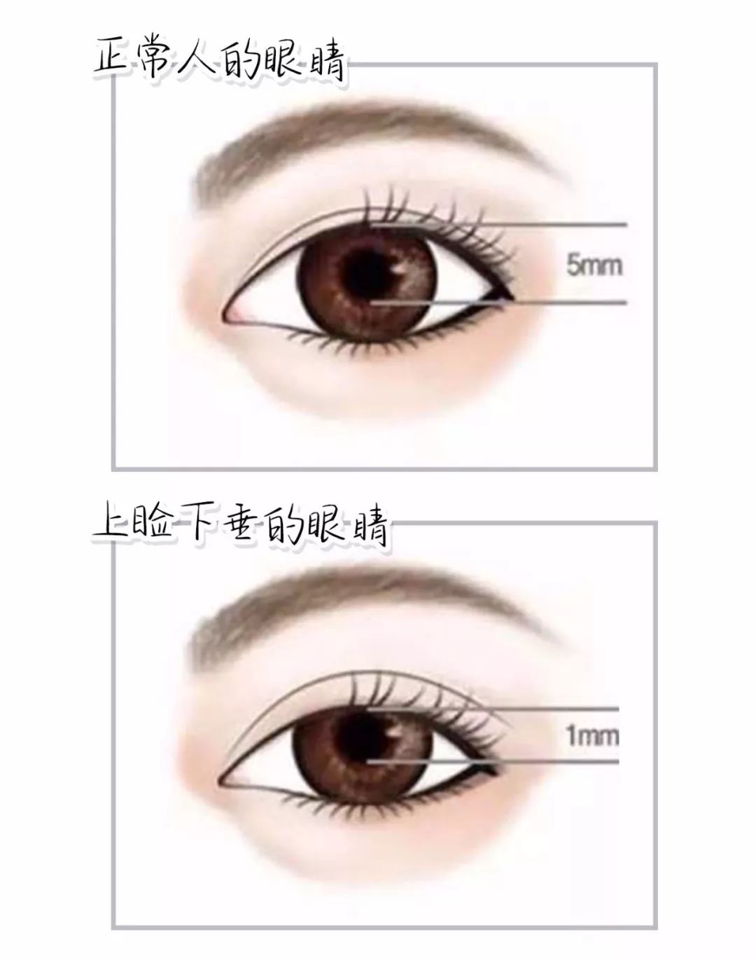 戚薇死鱼眼瞪人,戚薇死亡凝视