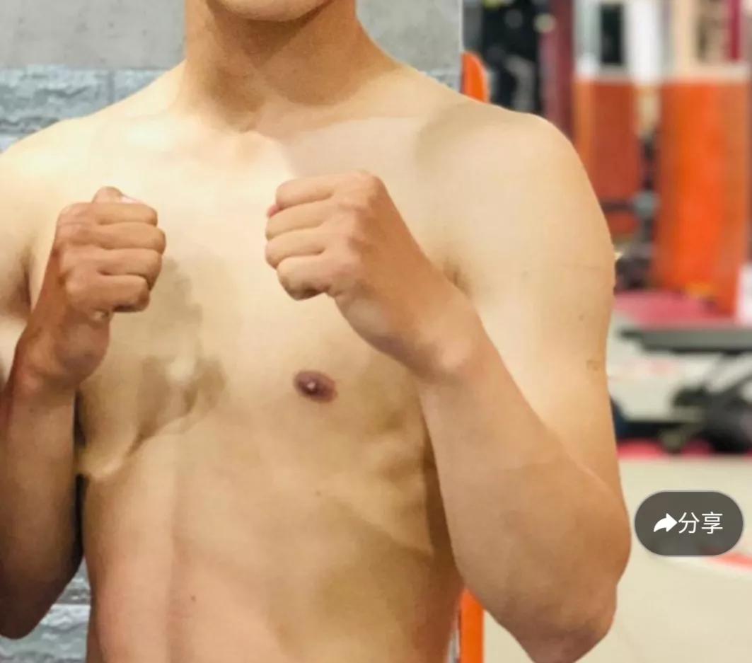 与鼻炎做艰苦斗争,和鼻炎抗争的小何