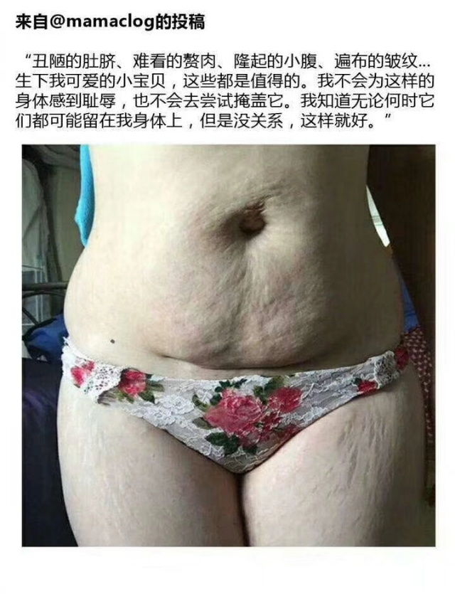 “产后恢复”到底恢复什么？