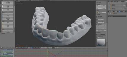 牙科隐形矫正器牙套制作,制作矫正牙套全过程